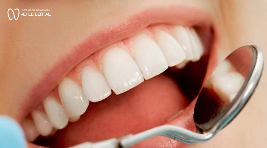 dấu hiệu răng sứ bị hở